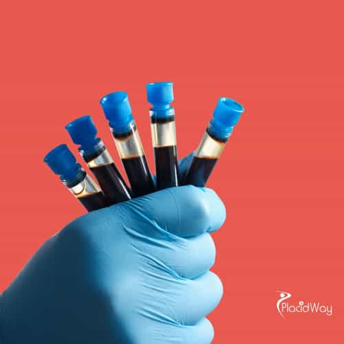 استعادة القوة والعافية: لماذا يختار المرضى النيجيريون الإمارات العربية المتحدة للعلاج بالخلايا الجذعية PRP